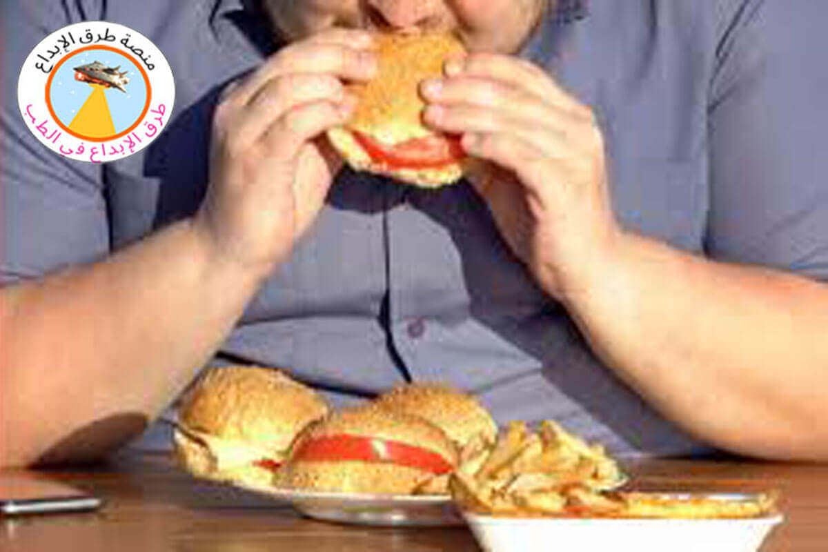الإدمان على الطعام الأعراض والعلاج 2